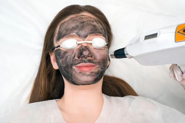 Carbon Laser Peel