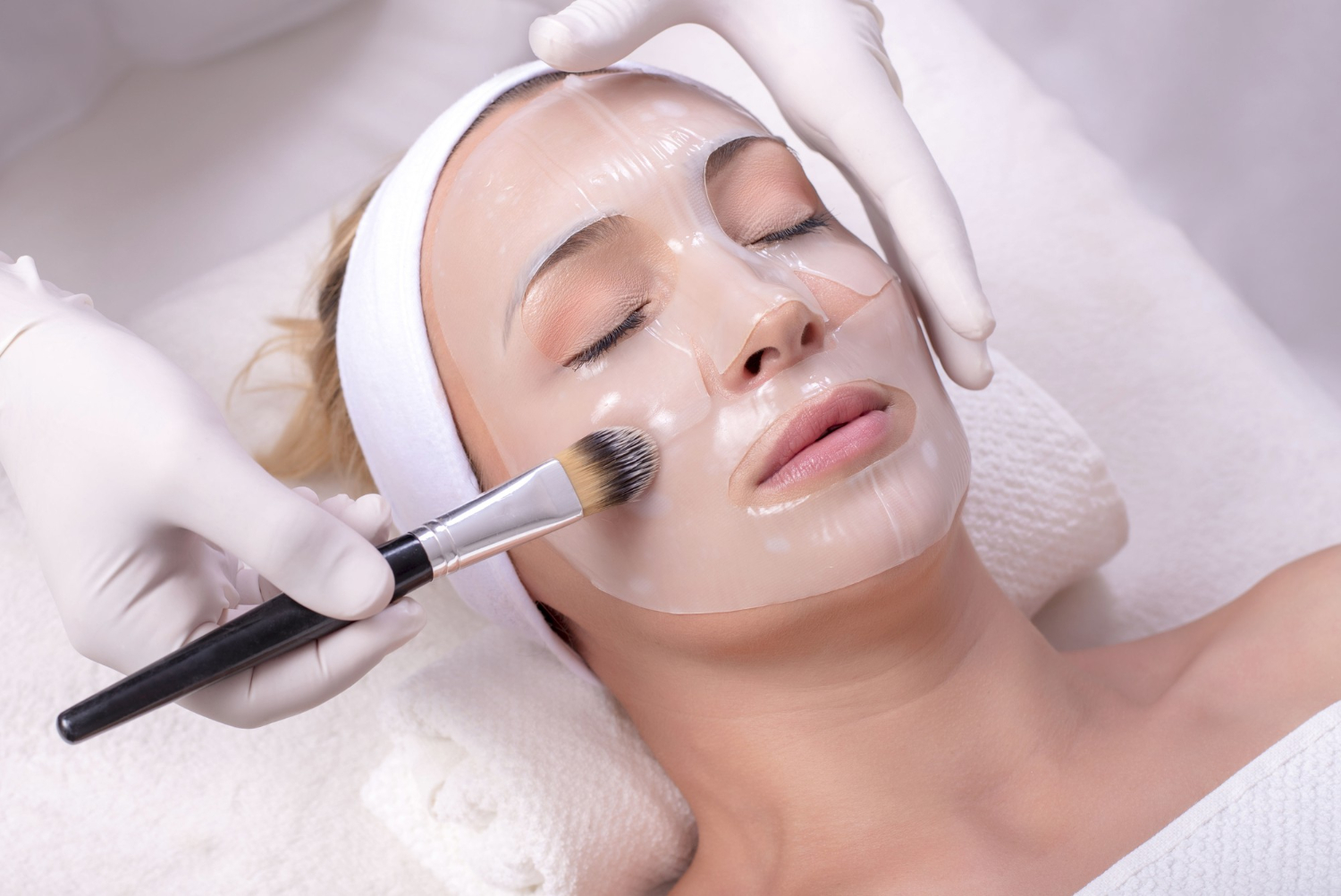 what is chemical peel treatment