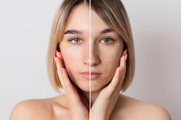 Skin Pigmentation treatment in kolkata