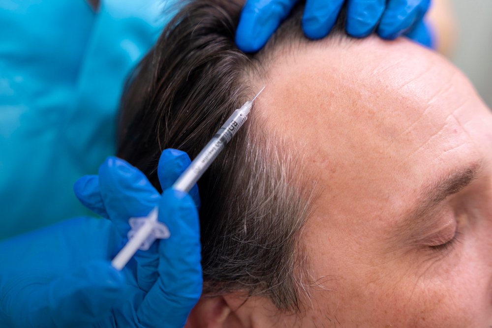 Scalp Injection